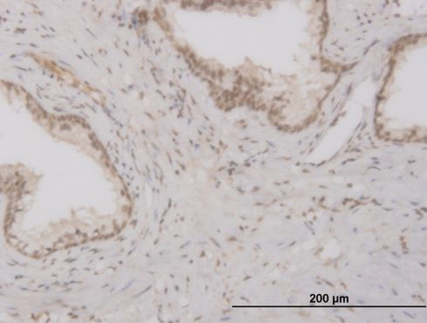 FOXO3A Antibody in Immunohistochemistry (Paraffin) (IHC (P))