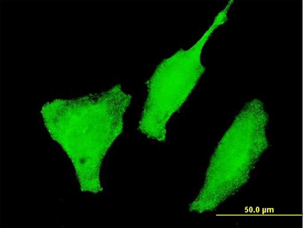 FOXO3A Antibody in Immunocytochemistry (ICC/IF)