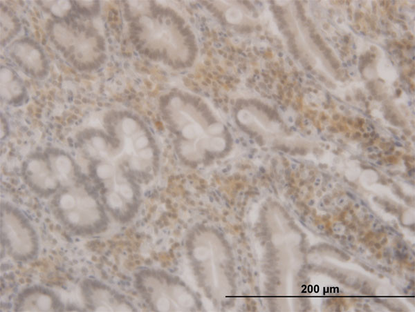 FOXO3A Antibody in Immunohistochemistry (Paraffin) (IHC (P))