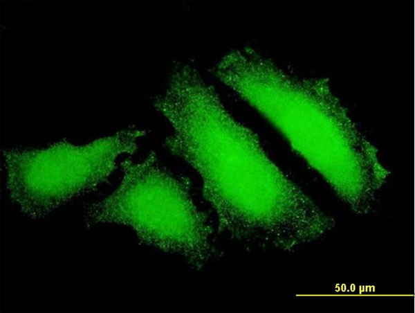 FOXO3A Antibody in Immunocytochemistry (ICC/IF)