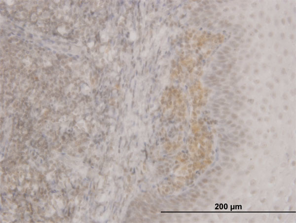 FOXO3A Antibody in Immunohistochemistry (Paraffin) (IHC (P))