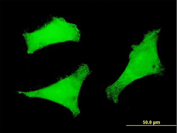 FOXO3A Antibody in Immunocytochemistry (ICC/IF)