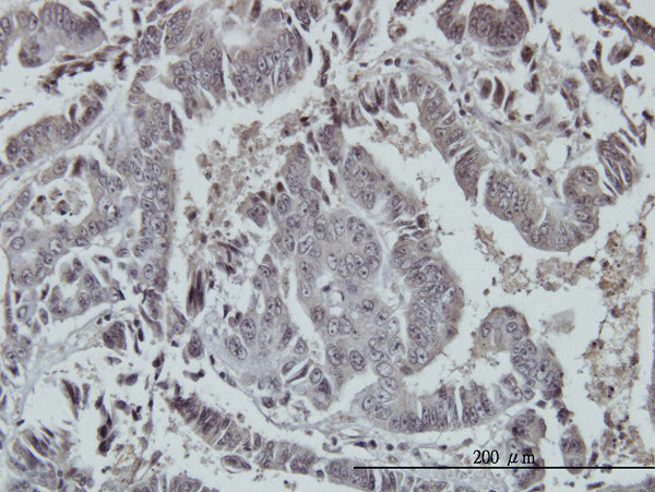 FOXO3A Antibody in Immunohistochemistry (Paraffin) (IHC (P))