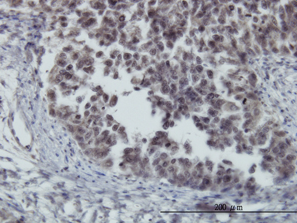 FOXO3A Antibody in Immunohistochemistry (Paraffin) (IHC (P))