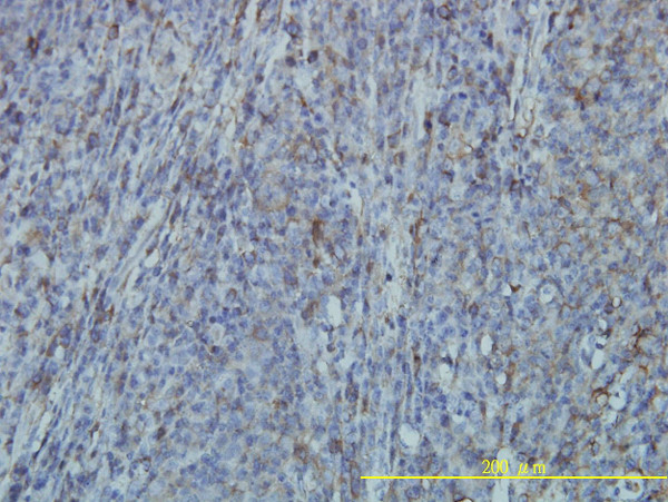 FLNA Antibody in Immunohistochemistry (Paraffin) (IHC (P))