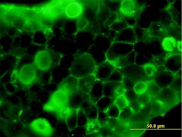 FLT1 Antibody in Immunocytochemistry (ICC/IF)