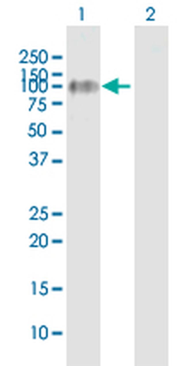 FLT1 Antibody in Western Blot (WB)