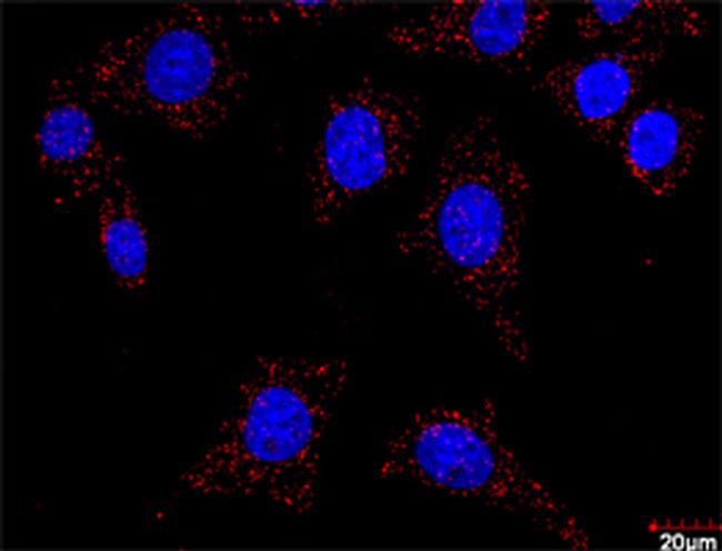 FLT1 Antibody in Proximity Ligation Assay (PLA) (PLA)