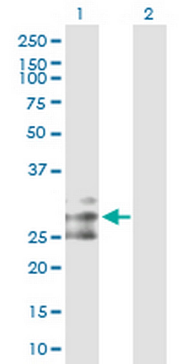 FLT3LG Antibody in Western Blot (WB)