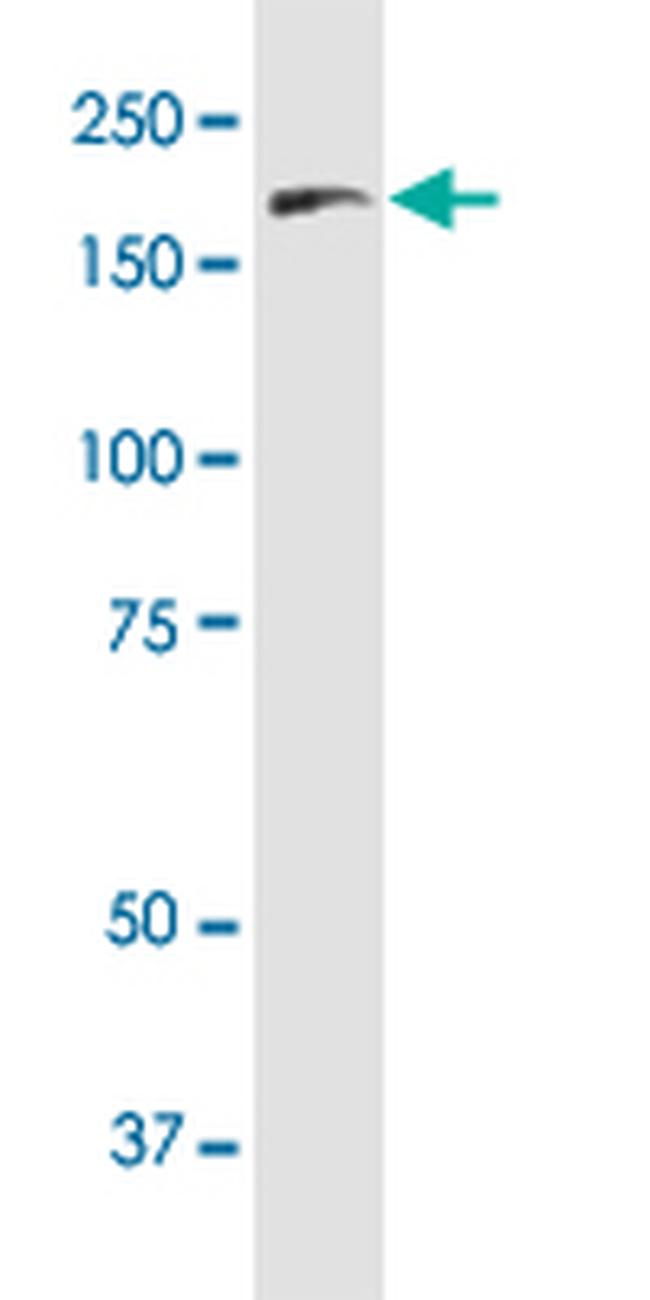 FLT4 Antibody in Western Blot (WB)