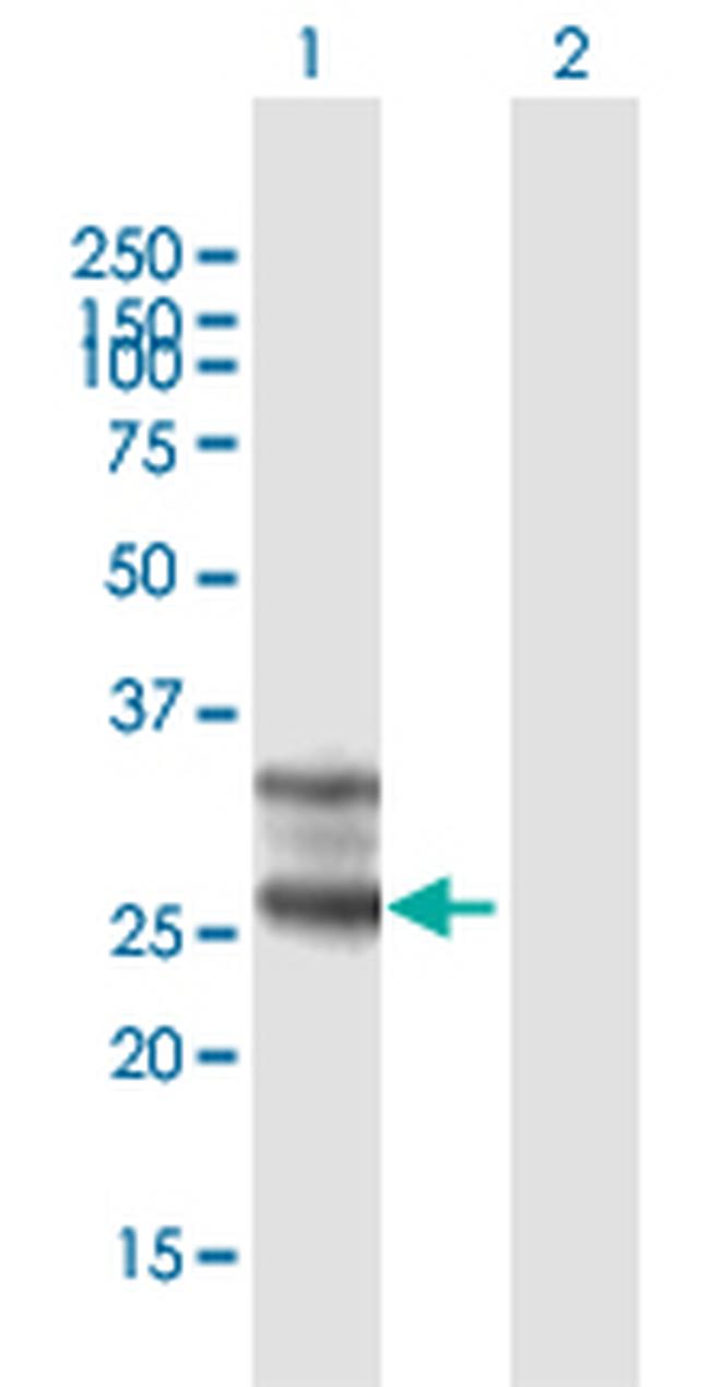 FOLR1 Antibody in Western Blot (WB)