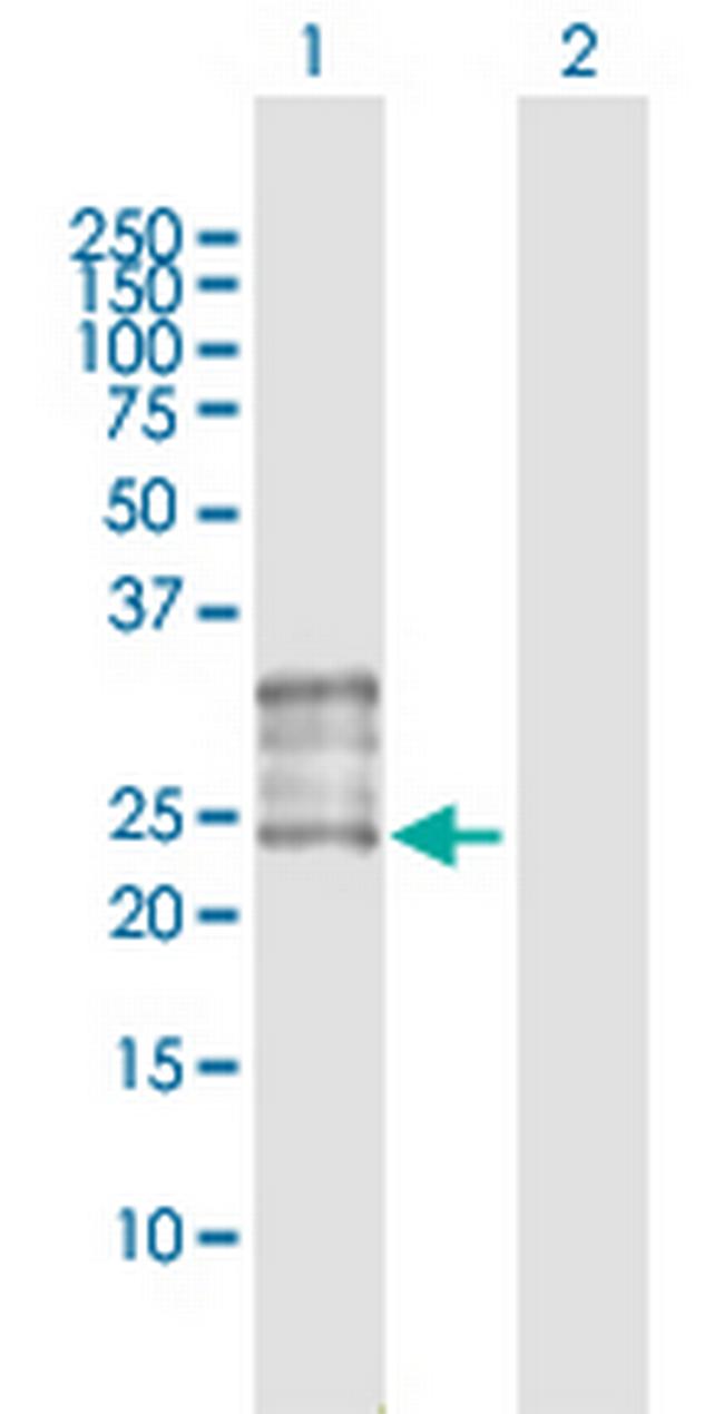 FOLR1 Antibody in Western Blot (WB)