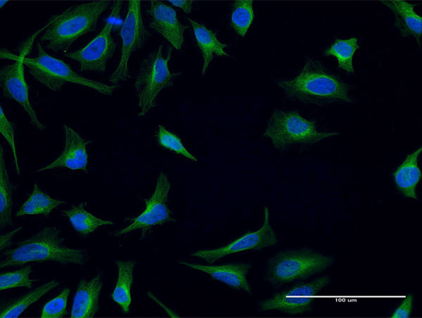 FPR2 Antibody in Immunocytochemistry (ICC/IF)