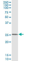 FXN Antibody in Immunoprecipitation (IP)