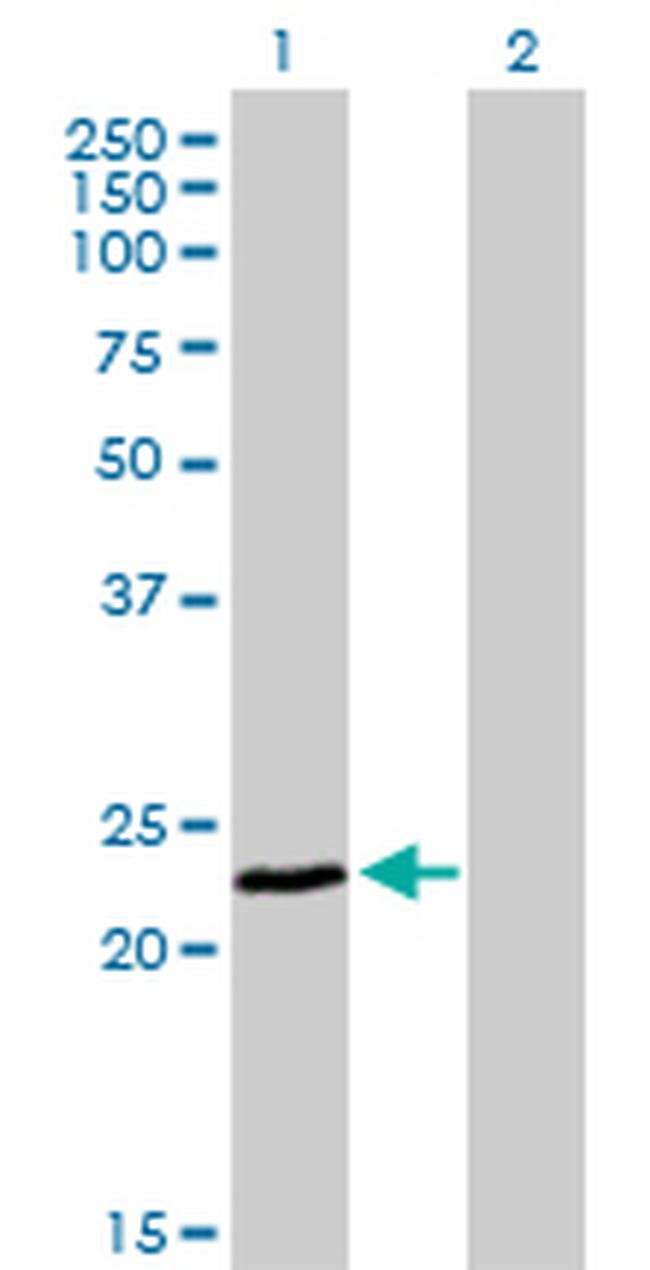 FXN Antibody in Western Blot (WB)