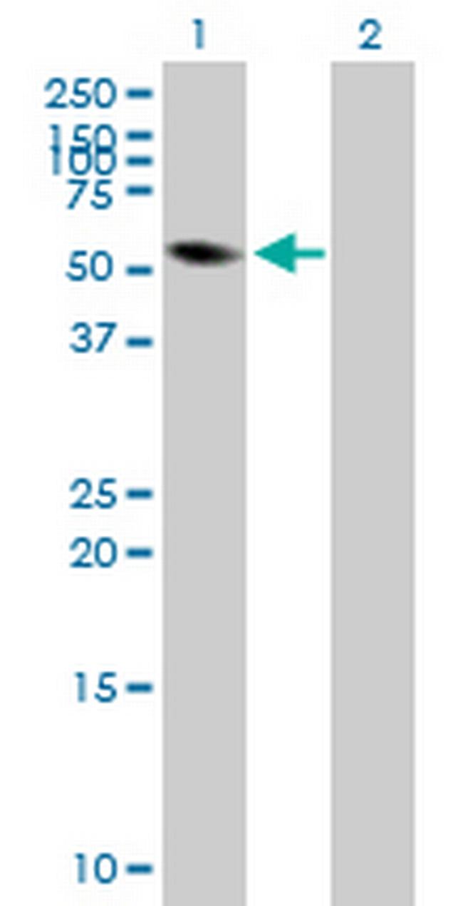 FRK Antibody in Western Blot (WB)