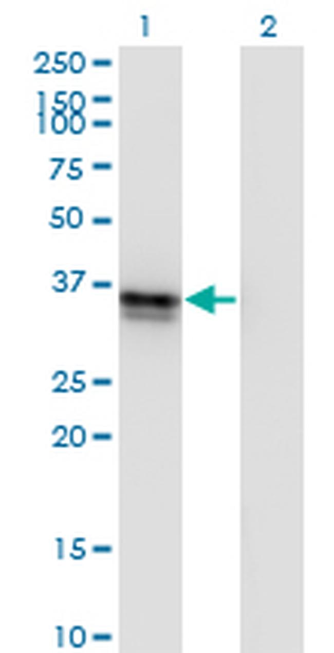 FRZB Antibody in Western Blot (WB)