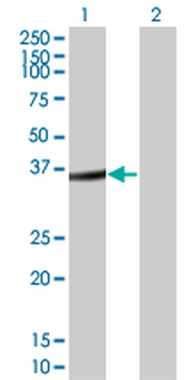 FRZB Antibody in Western Blot (WB)