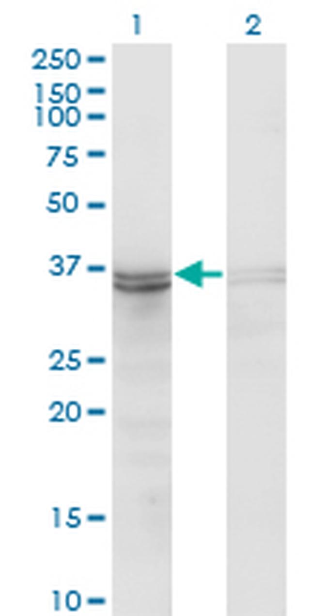 FRZB Antibody in Western Blot (WB)