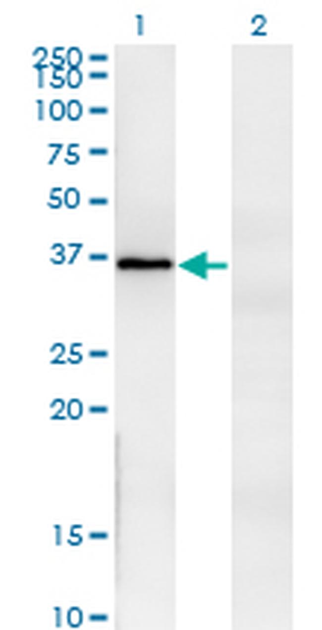 FRZB Antibody in Western Blot (WB)