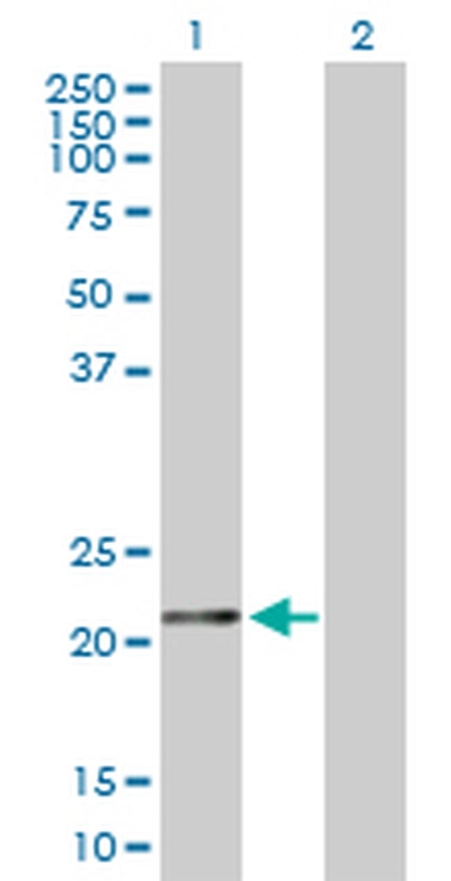 FTH1 Antibody in Western Blot (WB)