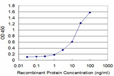 FTL Antibody in ELISA (ELISA)