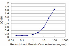 FTL Antibody in ELISA (ELISA)