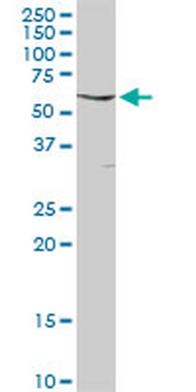 FYN Antibody in Western Blot (WB)