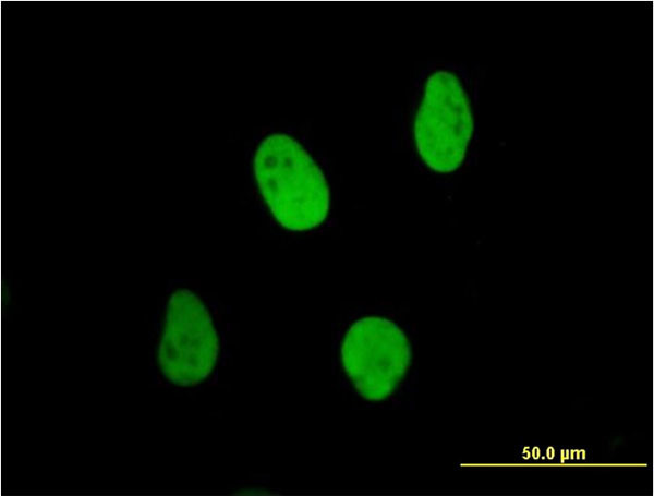 XRCC6 Antibody in Immunocytochemistry (ICC/IF)