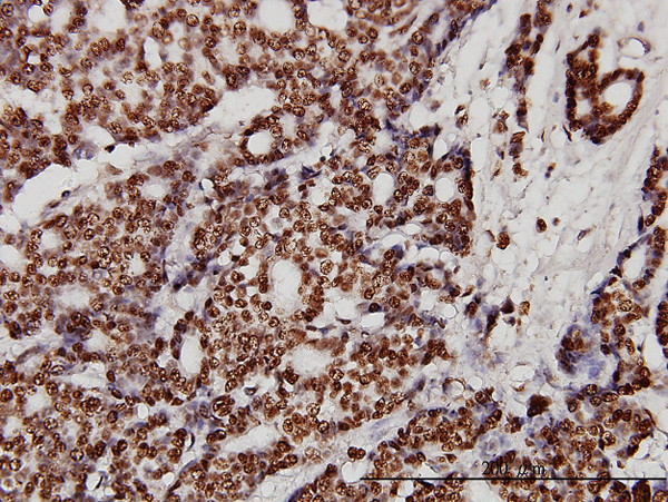 XRCC6 Antibody in Immunohistochemistry (Paraffin) (IHC (P))