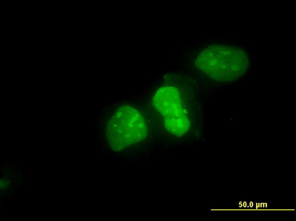 XRCC6 Antibody in Immunocytochemistry (ICC/IF)