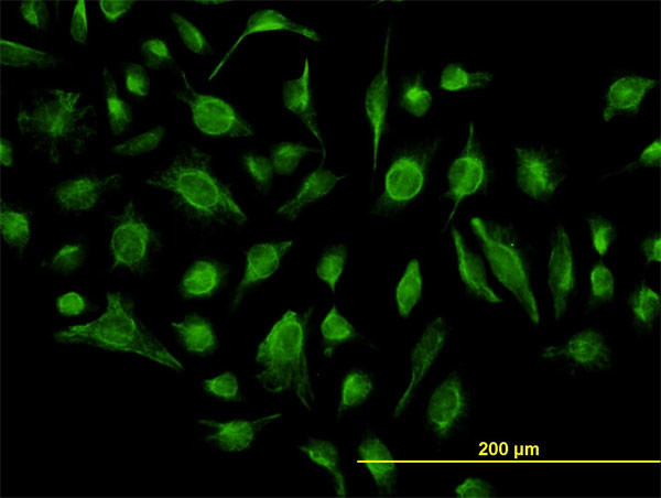 GABBR1 Antibody in Immunocytochemistry (ICC/IF)