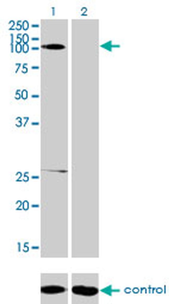 GABBR1 Antibody in Western Blot (WB)