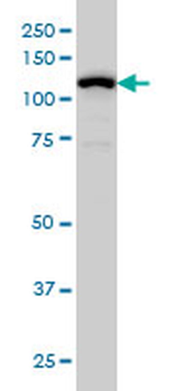 GABBR1 Antibody in Western Blot (WB)