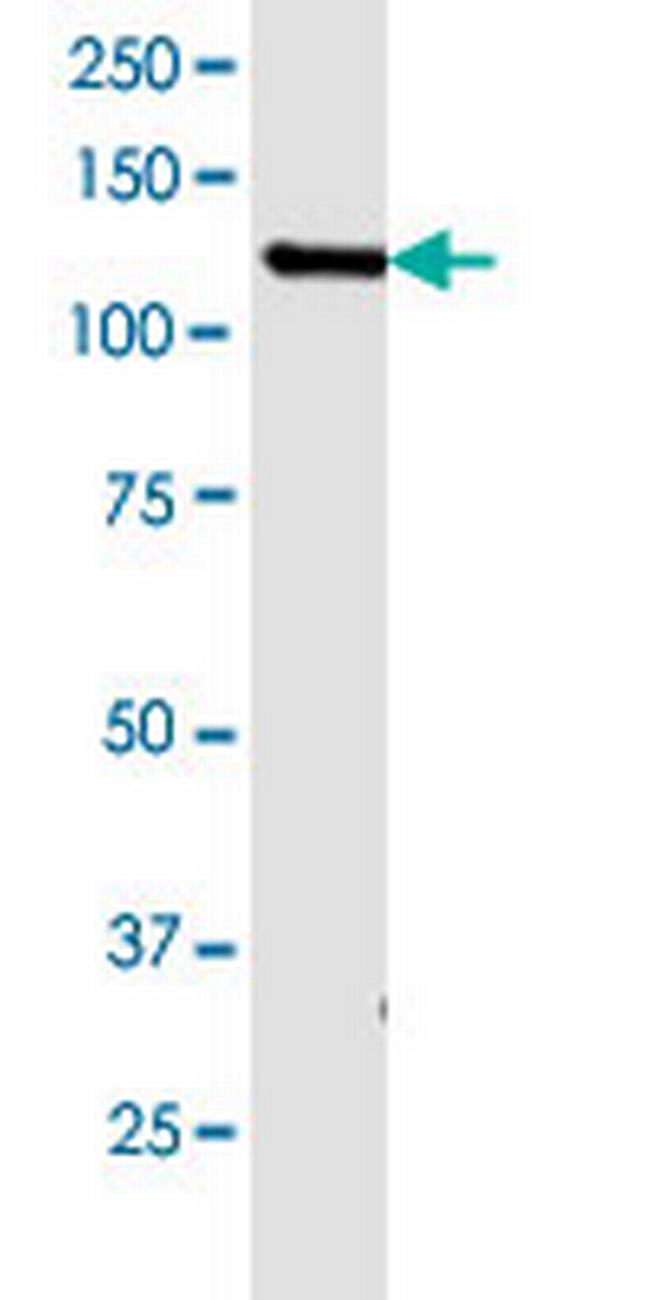 GABBR1 Antibody in Western Blot (WB)