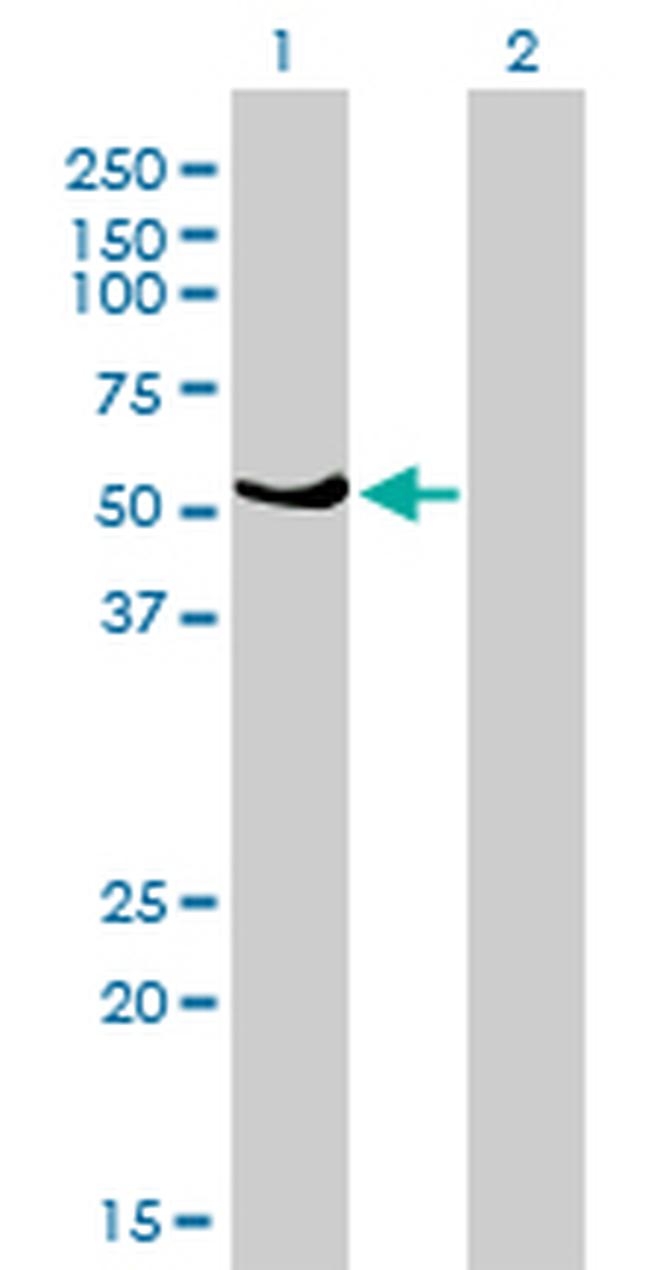 GABPA Antibody in Western Blot (WB)