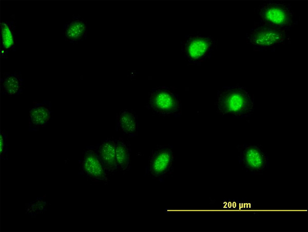 GABPA Antibody in Immunocytochemistry (ICC/IF)