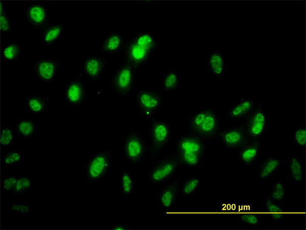 GABPA Antibody in Immunocytochemistry (ICC/IF)