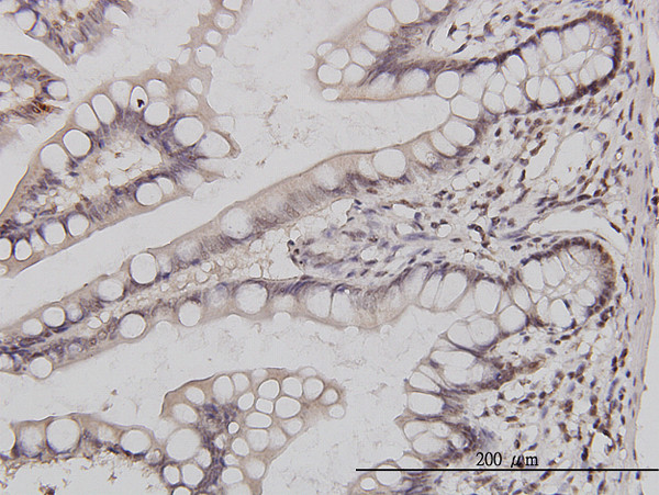 GABPA Antibody in Immunohistochemistry (Paraffin) (IHC (P))