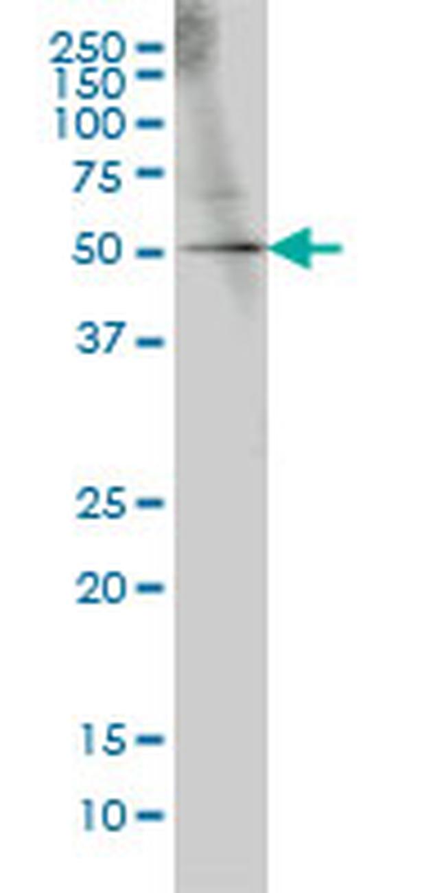 GABPA Antibody in Western Blot (WB)