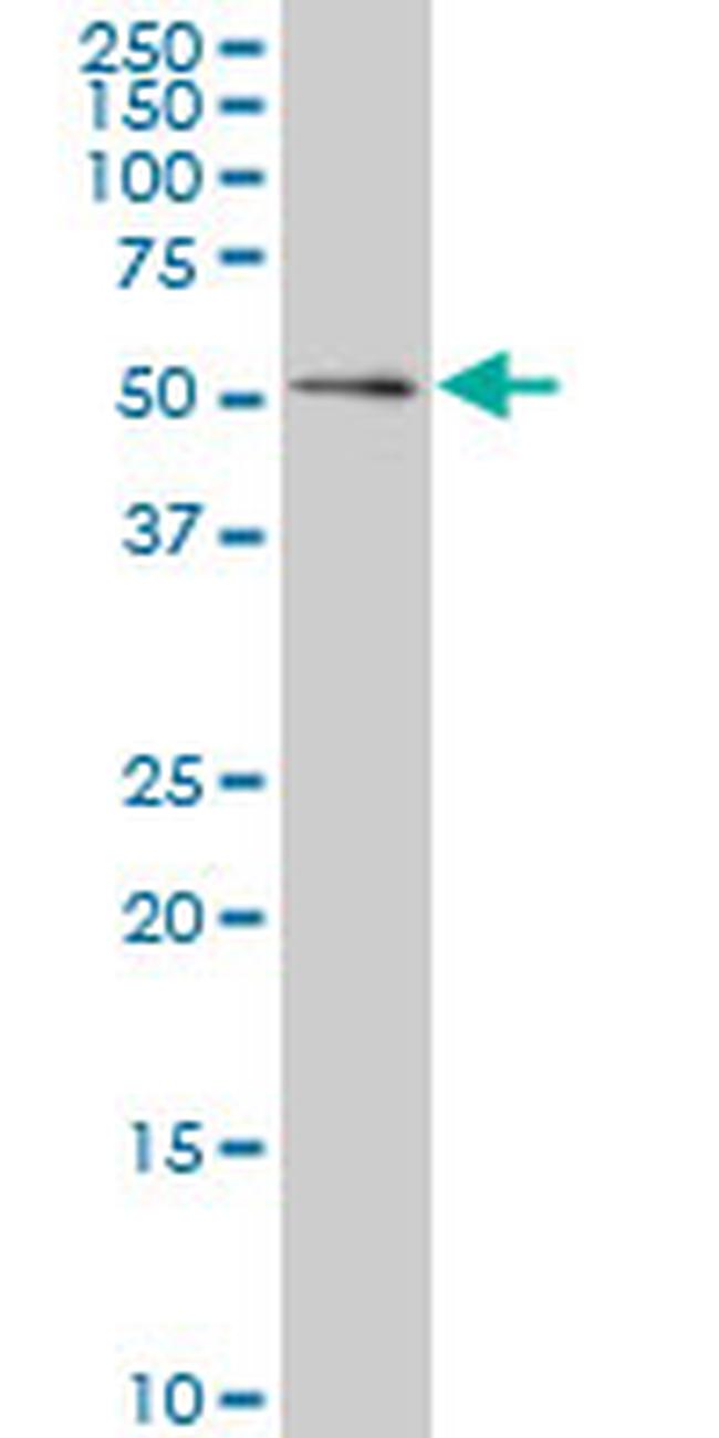 GABPA Antibody in Western Blot (WB)