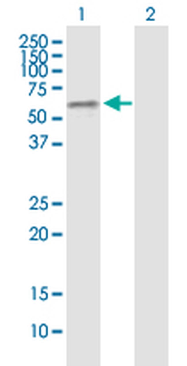 GABPA Antibody in Western Blot (WB)