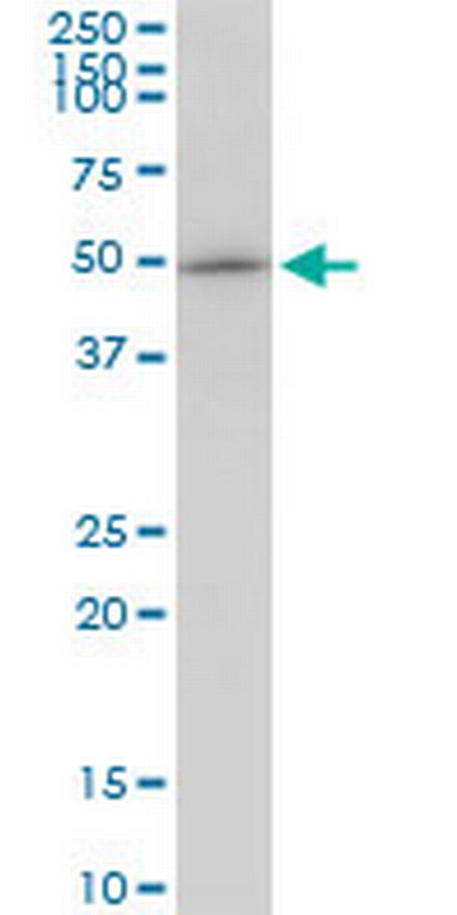 GABPB2 Antibody in Western Blot (WB)