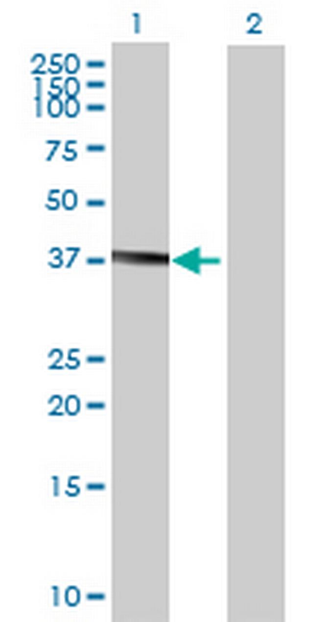 B4GALNT1 Antibody in Western Blot (WB)