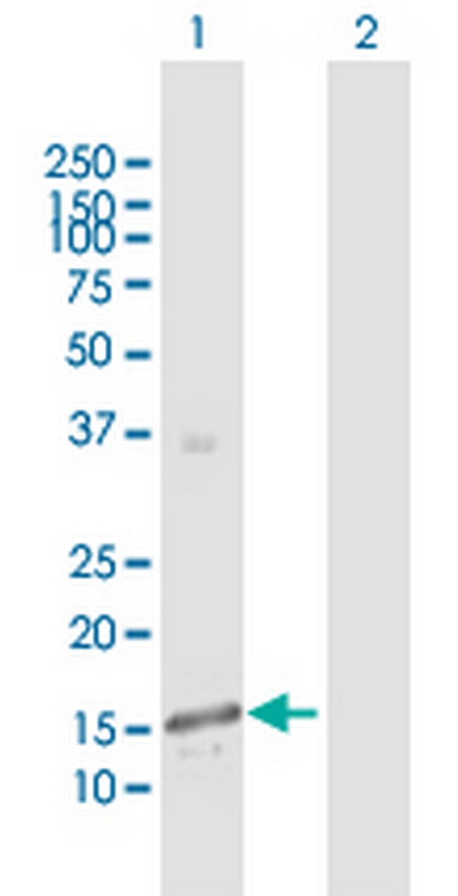 GALNT3 Antibody in Western Blot (WB)