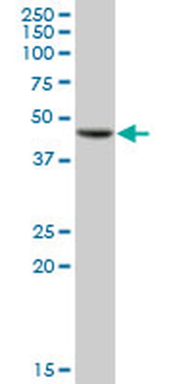 GALT Antibody in Western Blot (WB)