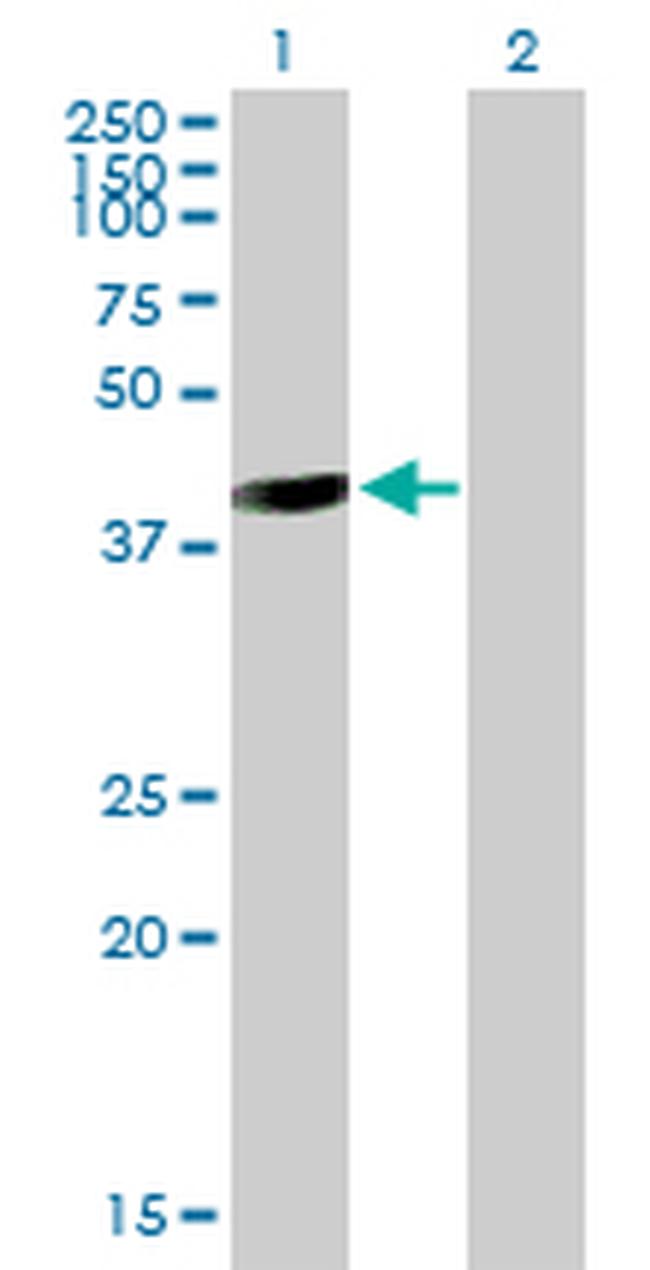 GALT Antibody in Western Blot (WB)