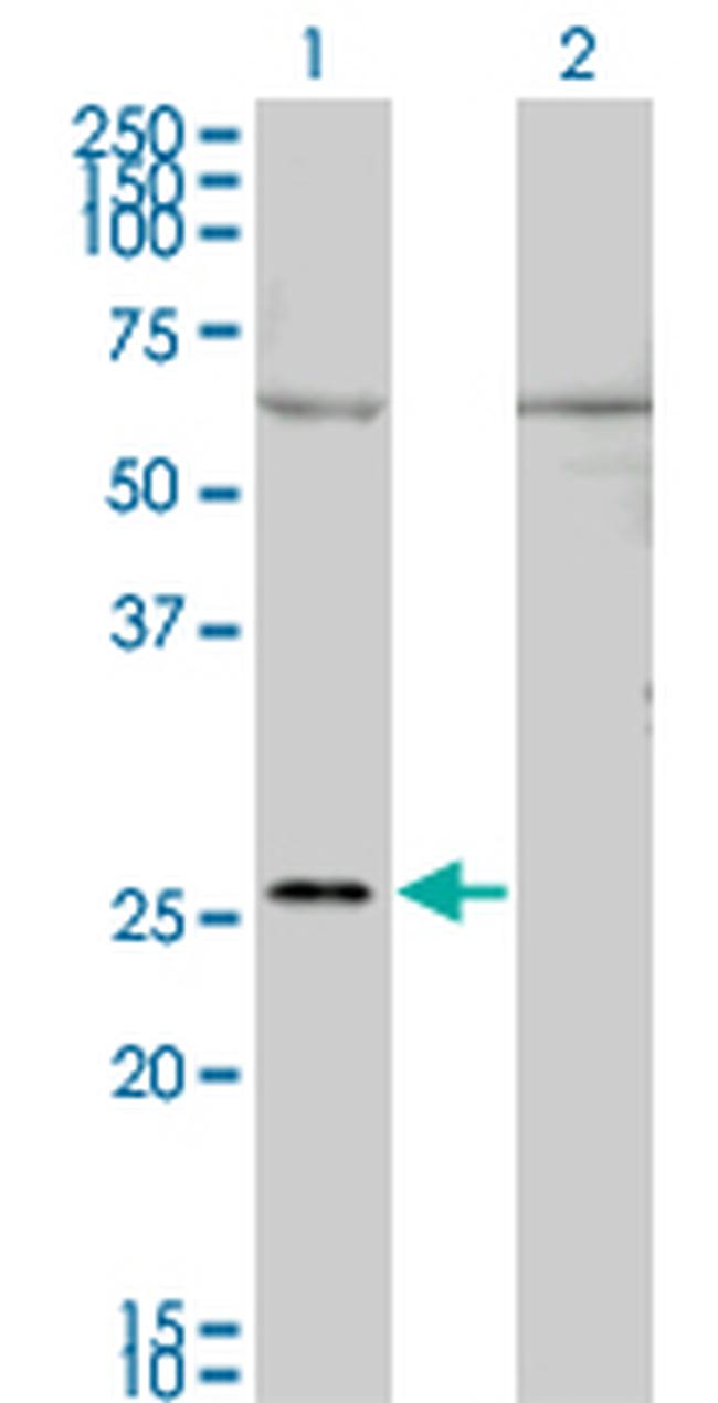 GAP43 Antibody in Western Blot (WB)