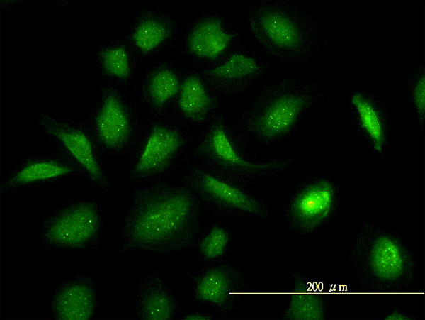 GART Antibody in Immunocytochemistry (ICC/IF)