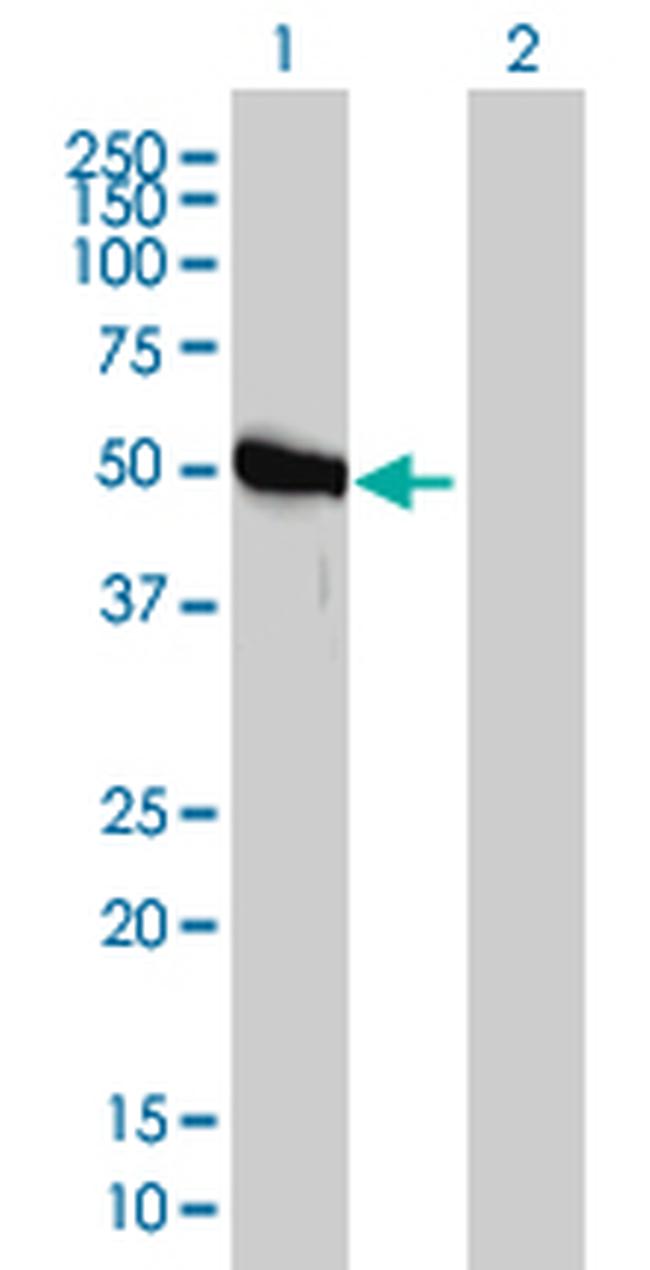 GART Antibody in Western Blot (WB)